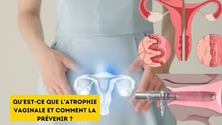 Atrophie Vaginale ou Vulvaire chez la Femme Ménopausée [upl. by Eixid283]