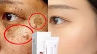 🔴Melasma Cream Collagen Japan Original Pekas Remover Cream Original amp Freckles Remover Pekas Remover [upl. by Anisor375]