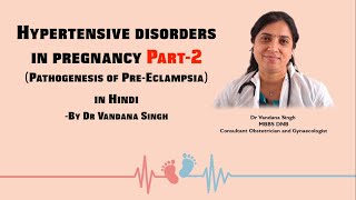 Episode8 Hypertensive disorders in pregnancy Part2 हिन्दी में by Dr Vandana Singh [upl. by Nasho555]