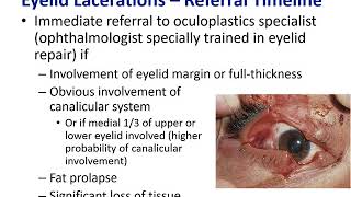 Trauma of the Periocular Structures [upl. by Jadda]