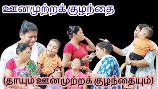 ஊனமுற்றக் குழந்தை  Autism Child  Heart Melt Skit skit drama familydrama shortfilm family [upl. by Boesch]