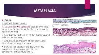 Cervical Cancer Osmosis Study Video [upl. by Nylime188]