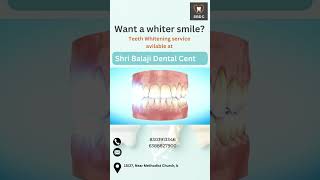 whitening teeth service  SBDC [upl. by Eanej297]