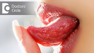 Common causes of ulcers on tongue in your 30s  Dr Aniruddha KB [upl. by Dnalwor]