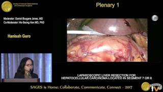 Laparoscopic liver resection for hepatocellular carcinoma located in segment 7 or 8 [upl. by Introc]