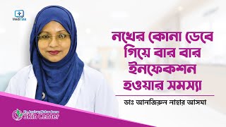 নোখের কোনা ডেবে যাওয়ার সমস্যা  Nail problem solution bangla [upl. by Kelsey742]