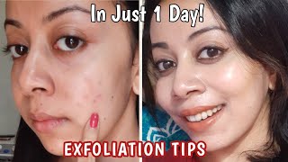 5 Exfoliation Tips for Clear Skin amp Glow How to exfoliate with Chemical Peels exfoliators [upl. by Flodur]