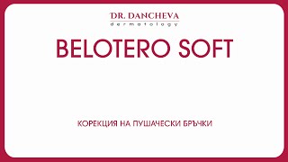 Др Ася Данчева  Корекция на пушачески бръчки с Belotero Soft Upper lip lines Smokers lines [upl. by Dorr]