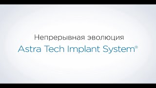 Astra Tech Implant System EV теперь в России [upl. by Coppins644]