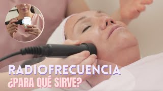 TODO SOBRE LA RADIOFRECUENCIA FACIAL Y CORPORAL DIATERMIA [upl. by Neelahtak23]