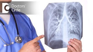 What is Asthmatic Bronchitis Is Asthma amp Bronchitis contagious  Dr Shivaraj A L [upl. by Hoyt277]