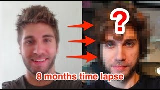 Mens LONG HAIR JOURNEY 2 Years A Time Lapse Of 1 Pic A Day [upl. by Reinold561]