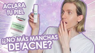 MEJORES COSMÉTICOS PARA MARCAS DE ACNÉ  CÓMO ELIMINAR MANCHAS DE ACNÉ EN CASA  SEPTIEMBRE 2021 [upl. by Eniffit]