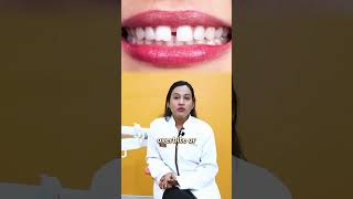 Tooth extraction before braces Is it necessary  Clove Dental shorts [upl. by Nolra]