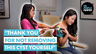 quotThank You for Not Removing this Cyst Yourselfquot Dr Lee Meets J Before Her Cyst Procedure [upl. by Jadwiga409]