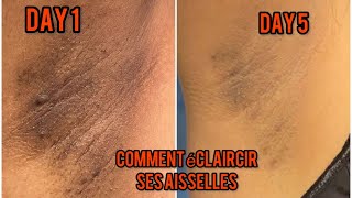 Comment éclaircir les aisselles sombres [upl. by Ciardap119]