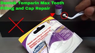 ✅ How To Use Dentek Temparin Max Tooth Filling and Cap Repair Review [upl. by Rramaj963]