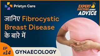 Fibrocystic Breast Disease in Hindi [upl. by Sarine]