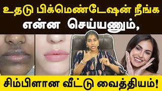 உதடு சுற்றி கருமை இருந்தால் எப்படி போக்குவது  How to remove blackness around mouth naturally [upl. by Raual]