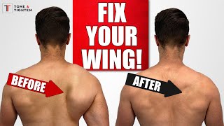 FIX Scapular Winging with Shoulder Blade Exercises [upl. by Kiehl140]