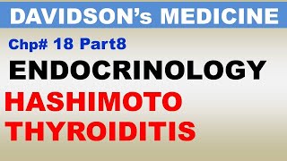 Davidsons Medicine Chp18 Part8  HASHIMOTO Thyroidits  Endocrinology  Dr Asif Lectures [upl. by Nolyad]