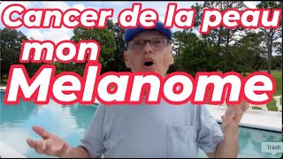 Cancer de la peau MON Melanome Comprendre pourquoi je lai fabrique et comment le faire disparaitre [upl. by Ahsikyw]