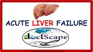 ACUTE LIVER FAILURE by DoctScape [upl. by Ralina183]