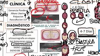 Obstetricia  4 RM19 2V DÍA 2 OBSTETRICIA GESTACION MULTIPLE de Qx Medic on Vimeo [upl. by Mattias]