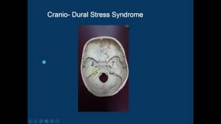 Cranial Release Technique CRT  The Cranial Base [upl. by Animor]