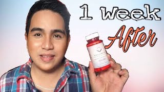 RELUMINS GLUTA1000 REVIEW AFTER 1 WEEK  Edrian Sasutil [upl. by Survance]