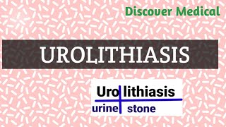 Urolithiasis  Reason Symptoms Diagnosis  Kidney stones [upl. by Atse19]