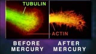 NeuroToxin  Mercury Melts Your Brain [upl. by Eiddal204]