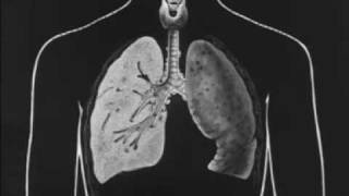 Tuberculosis and How it May be Avoided 1930 Pt 1 of 3 [upl. by Nottnerb]