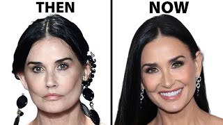 Demi Moores NEW FACE  Plastic Surgery Analysis [upl. by Gauldin]