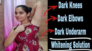 Dark UnderarmDark ElbowsDark Knees Whitening Solution nimmaashwini underarmwhitening [upl. by Sucram]