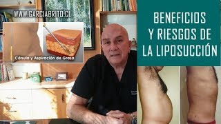 EL DR ENSEÑA  BENEFICIOS Y RIESGOS DE LA LIPOSUCCIÓN [upl. by Yraht]