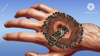 asmr trypophobia infected hand treatment video  ASMR animation treatment video [upl. by Araz369]