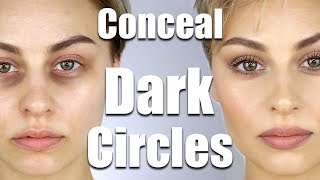 How To Conceal Dark Circles Under Eyes  Alexandra Anele [upl. by Callean]