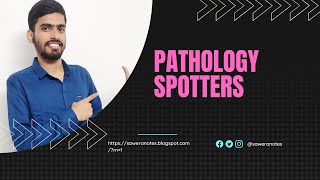 Spotters of pathology practical exam  Pathology spotters [upl. by Aihseyt246]