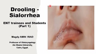 Drooling Sialorrhea ENT trainees and Students Part 1 [upl. by Goldarina220]