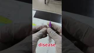 Needle stick injury 💉 kya hota hai neet mbbs motivation knowledge [upl. by Aihsekram675]