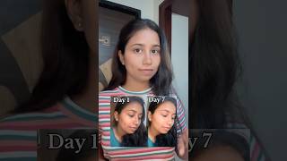 My Dark spots reduces in just 7days  Chemist at Play [upl. by Tnomal485]