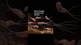 The H pylori bacteria that causes ulcers [upl. by Audette]