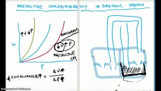 Restrictive Cardiomyopathy and Diastolic Dysfunction [upl. by Niawat]