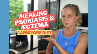 Healing AUTOIMMUNE Conditions with Carnivore Diet  Psoriasis and Eczema 2022 [upl. by Fran558]