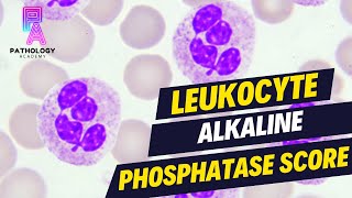 LAP SCORE Leukocyte Alkaline Phosphatase Score  By Dr Aditi Kumar [upl. by Cowan]