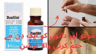 Remove mols and warts and acne remove solution within one Lotion 🧴  Duofilm Lotion [upl. by Gurtner485]