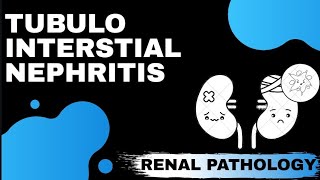 DRUG INDUCED TUBULO INTERSTIAL NEPHRITIS  Renal Pathology  Med Bees [upl. by Bresee]