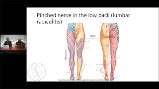 Bulging discs Causes Symptoms and Treatment Options [upl. by Greenwell]