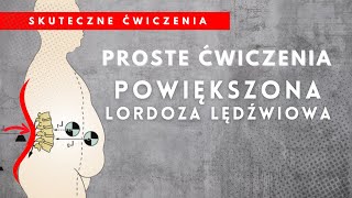 Powiększona Lordoza Lędźwiowa  Ćwiczenia  OTYŁOŚĆ BRZUSZNA [upl. by Gnivri]